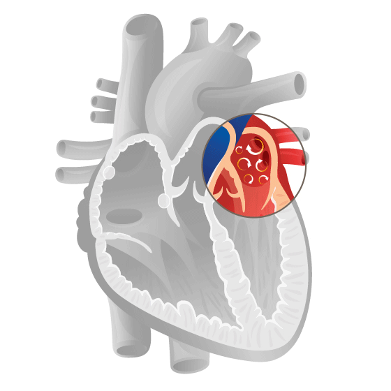 Visualisierung Herz-Vorhoffimmern 