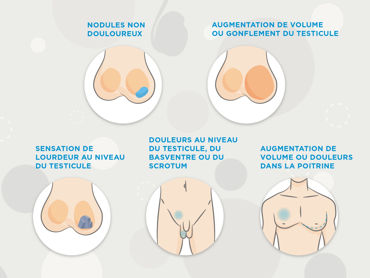 Savoir Palper Les Testicules Correctement Hirslanden Savoir Palper Les Testicules Correctement Hirslanden