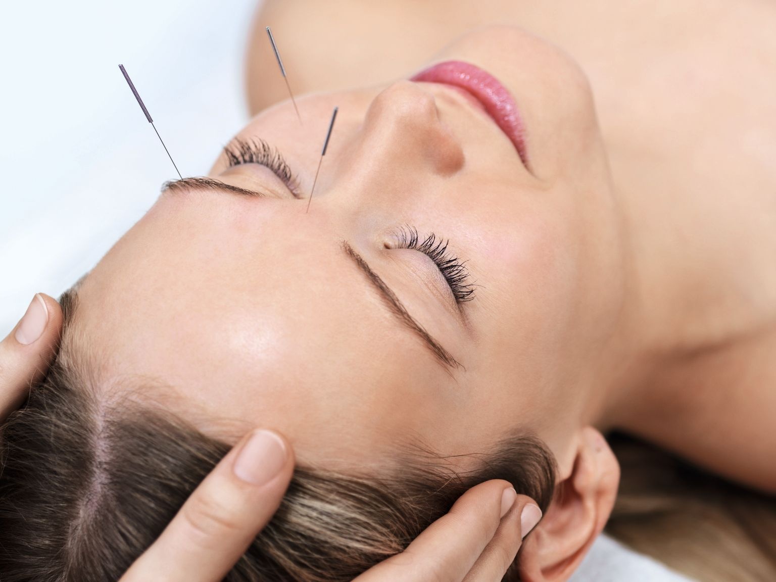 Acupuncture Hirslanden Clinique Des Tilleuls
